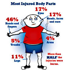 firework injuries