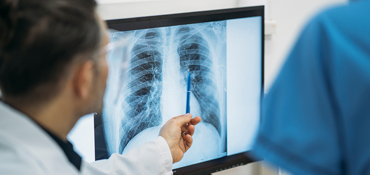 doctor pointing at xrays on a screen